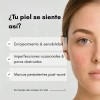 Nineless Sérum Facial Ácido Azelaico 10% Controla Imperfecciones y Brillo