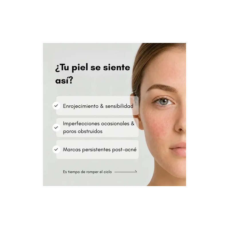 Nineless Sérum Facial Ácido Azelaico 10% Controla Imperfecciones y Brillo