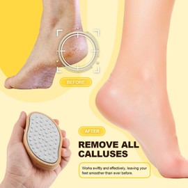 SG Nekoo Stainless Steel Foot Scrubber Shower(1 PCS) - Nano-Glass Pedi Egg Pumice Stone for Feet Dead Skin, Plastic-Free Pedicure Foot File Callus Remover - Bamboo Handle