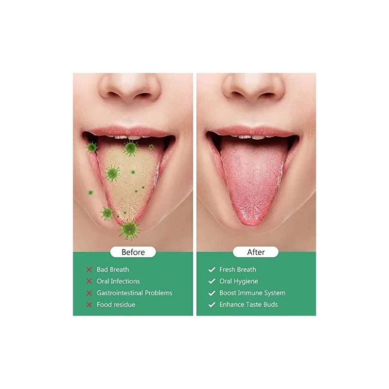 TOPOST Limpiador Raspador de Lengua, Tongue Scraper con Estuche