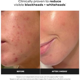 Paula's Choice Skin Perfecting - Líquido salicílico exfoliante 2% BHA, exfoliante facial para puntos negros, poros grandes, arrugas y líneas finas