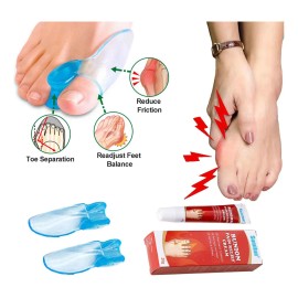 Pomada Para Dolor De Juanetes S Pomada Para Reumatismo Para