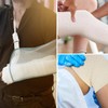 Elastic Tubular Bandage Tubular Compression Bandage Fixation Bandage Support Bandage