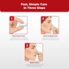 Sangrado nasal