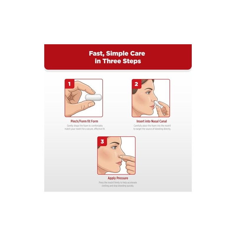 Sangrado nasal