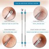 USCOLOR Pimple Remover Tool Kit Blackhead Extractor Comedone Acne Spot