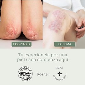 Crema Atopica Para Piel DERMABON - Crema Hidratante Facial - Tratamiento de Psoriasis Resequedad Eczema Acne - Crema Para Piel Seca - Crema Corporal 1