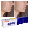 ANTI- ACNÉ Anti Acne Crema Cicatrices Cacarizos Grasa Tratamiento Piel