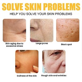 Crema de Agua de Arroz ANGGREK, Crema Facial Reparadora de Arroz de 1,8 Oz, Crema Hidratante para la Cara que Se Desvanece, Repara las Lneas Finas,...