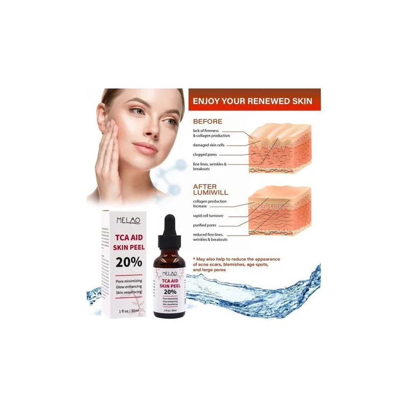 . 30 Ml De Tca Aid Exfoliante Para La Piel,