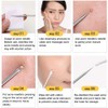 Blackhead Removal Kit, Blackhead Remover, 4 Piece Set with Storage