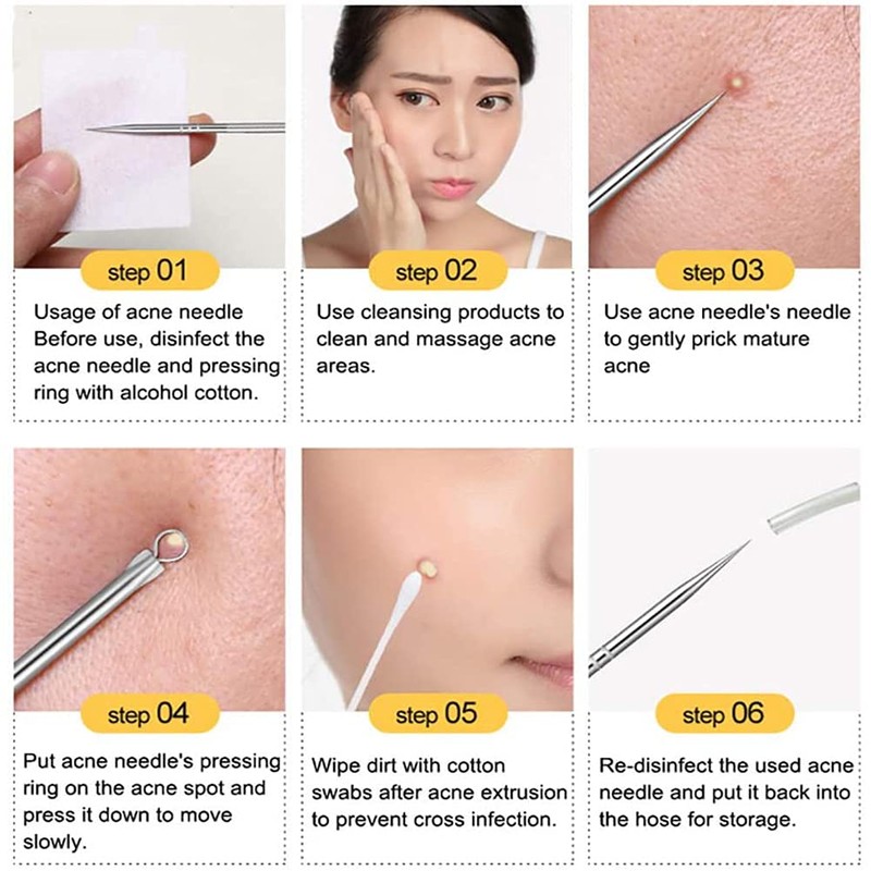 Blackhead Removal Kit, Blackhead Remover, 4 Piece Set with Storage