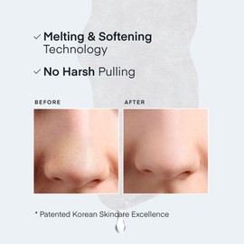 Melting Pore Strips Blackhead Remover: Sebum Softener, Pore Minimizer Strips & Blackhead Remover Tool - Hypoallergenic Tested Korean Skincare Pore Refining - 3-Step Nose Pore Treatment Patches, 5 Kits