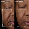 StriVectin Tighten and Lift Peptight Face Lift Serum, con péptidos