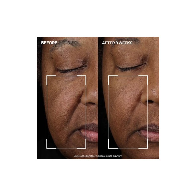 StriVectin Tighten and Lift Peptight Face Lift Serum, con péptidos