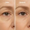 Vitalis Suero Para Crecimiento De Pestañas 100% Natural Lash