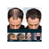 Tratamiento East Moon Para Crecimiento De Pelo Y Barba, .