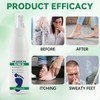 2pcs Foot Spray with Tea Tree Oil, Tea Tree Oil