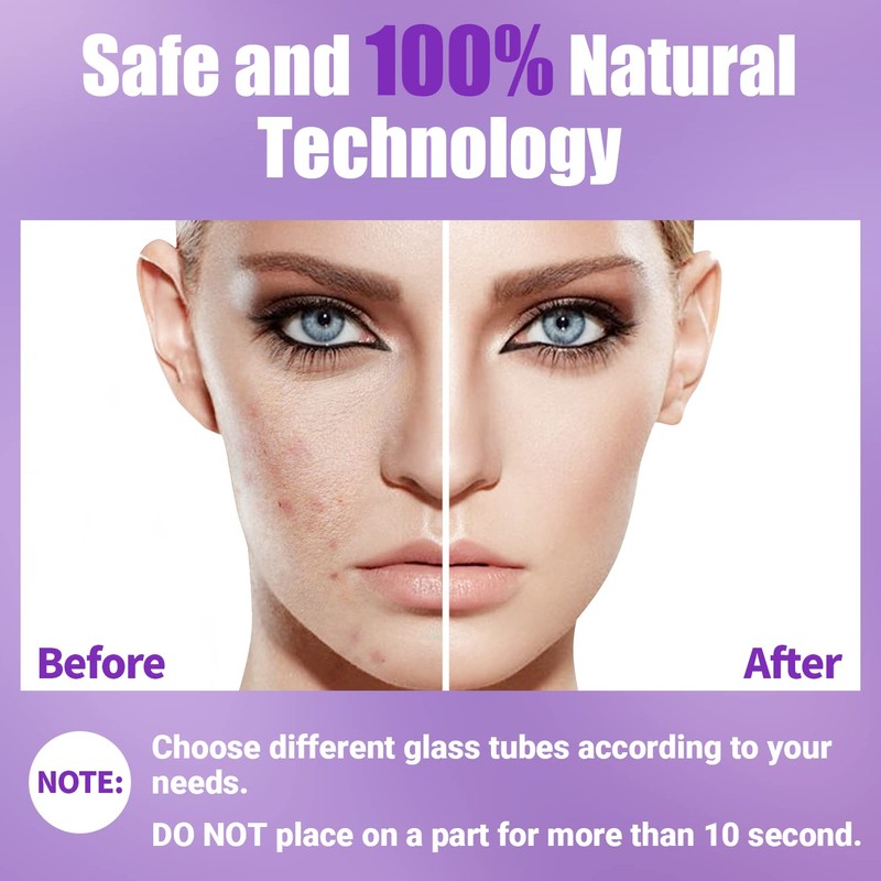 High Frequency Facial Wand-UUPAS Portable Handheld High Frequency Facial Machine