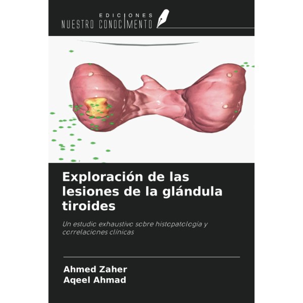 Exploración de las lesiones de la glándula tiroides: Un estudio