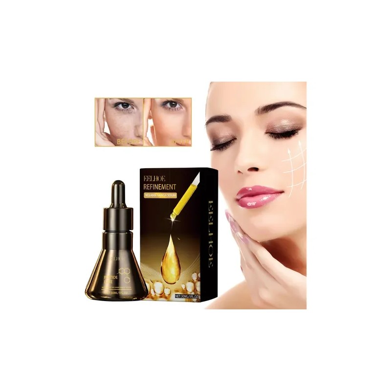Ee Serum Aclarante, Reduce Manchas Del Rostro, Hidratante