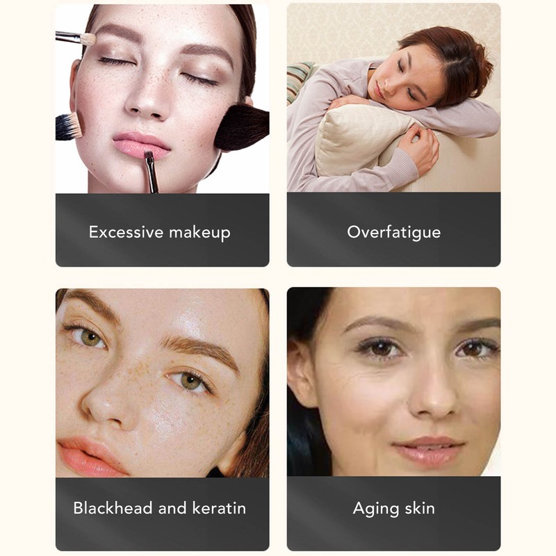 Face Skin Spatula Deep Cleaning High Frequency Vibration Skin Care