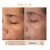Crema Facial Hidratante Dermoaclaradora Anti Acne 4 Pack Todo Tipo