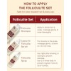 e70 Tratamiento De Foliculitis Con Ácido Salicílico Para Eliminar La