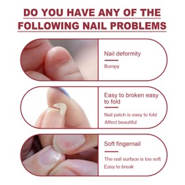 Nail Glue Instant Cracked Nail Repair Gel, Nail Treatment Repair Gel, Nail Repair Kit for Broken Natural Nails, Nail Strengthener Fixer and Hardener for Nail Extensions Sculpture Gel (20 ML)