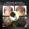 Fibras Capilares Naturales 25g Disimular Calvicie Cabello F