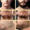 Apolo Cosmetics Para Barba, Estimulante De Barba Apolo,2
