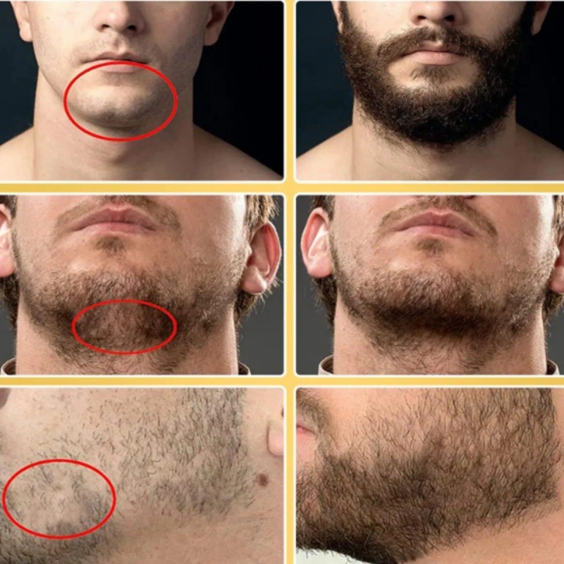 Apolo Cosmetics Para Barba, Estimulante De Barba Apolo,2