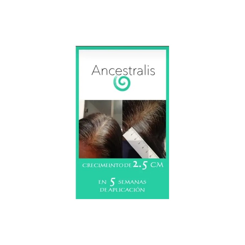 Shampo Anticaída Cabello Ancestralis