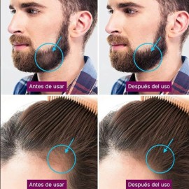 Dermaroller Facial Capilar Barba Regenera Colágeno 0.5-2 Mm