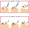 EasyULT 2 in 1 Tick Remover, Stainless Steel Professional Tick