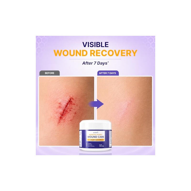 PURESKIN Manuka Honey Wound Care: Manuka Honey Wound Gel -