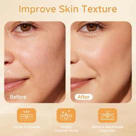 Peel Shot Glow Rice Ampoule Duo, Black and White Rice Exfoliant for Face and Body, Rice Exfoliator for Faces Dead Skin Cells Remover, Face Peel Shot Serum for Softens Cuticle (White+Black, 160ml)