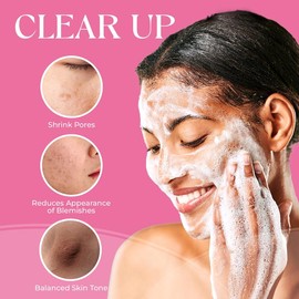 SAISZE Kojic Acid & Turmeric Soap Bars with Vitamin C, Retinol & Collagen – Skin Nourishing & Hydrating Soap – 65g x 3 Bars Skincare Cleanser