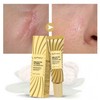 Joyfrit Post-Cesarean & Scratch Repair Body Care Cream One Size / 40