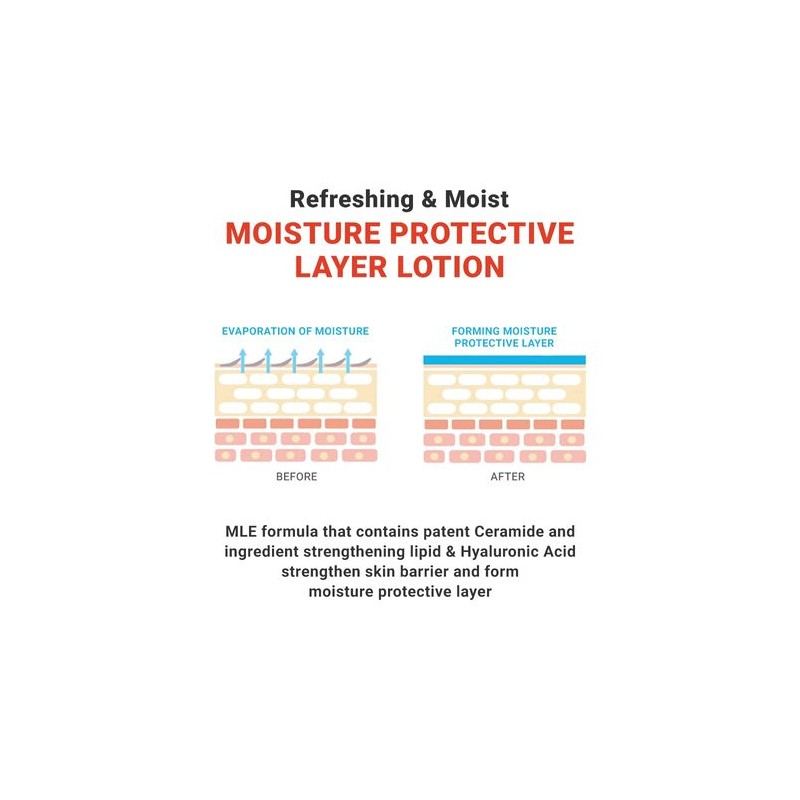 ATOPALM [ATOPALM]*renewal* MLE Lotion 120ml