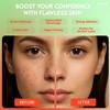 Pimple Patches Korean Skincare: Extra Absorbent 144 Patches Hydrocolloid Dots