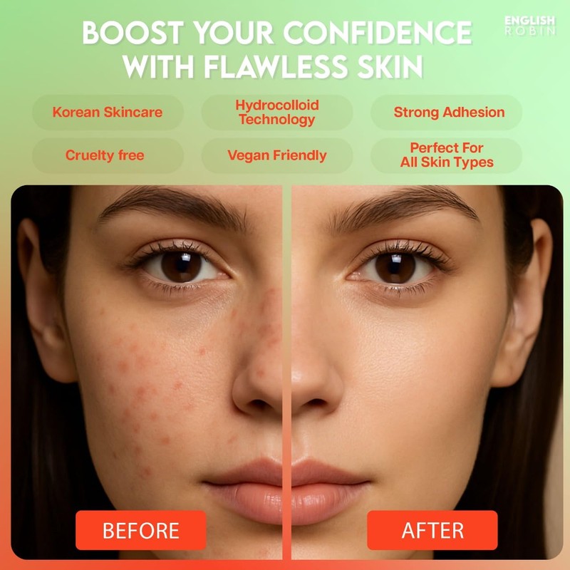 Pimple Patches Korean Skincare: Extra Absorbent 144 Patches Hydrocolloid Dots