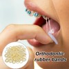 300 Pcs Orthodontic Elastic Bands – Durable Braces Bands for