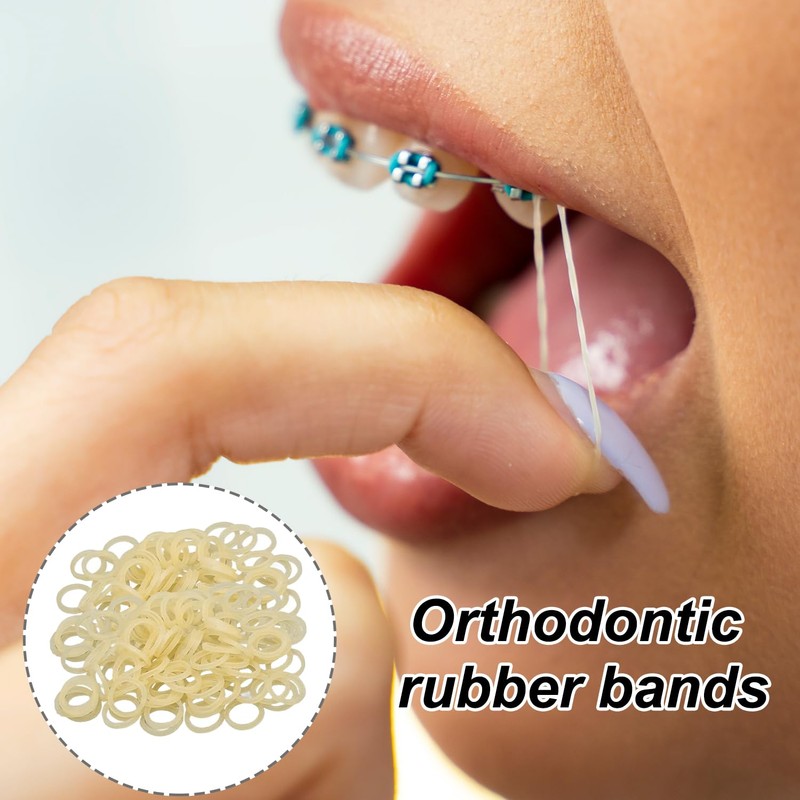 300 Pcs Orthodontic Elastic Bands – Durable Braces Bands for
