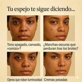 Vitamina C Booster Shot Serum Iluminador, Crema Esencial con Vitamina C, Tónico Hidratante, Mejora el Tono y Suavidad de la Piel, Reduce Arrugas (2 PCS) Práctico y profesional
