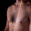 ELMARIS® - Hair removal for men: for intimate areas and
