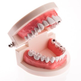 Dental Caries Teaching Model 1:1 Adult Life Size - Non-Removable Teeth Model for Education - Ideal for Demonstrations and Learning Dental Structures for Students Patients Professionals