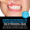 Starlite Smile Blue Light Red Light Gum Light, Periodontal Light,