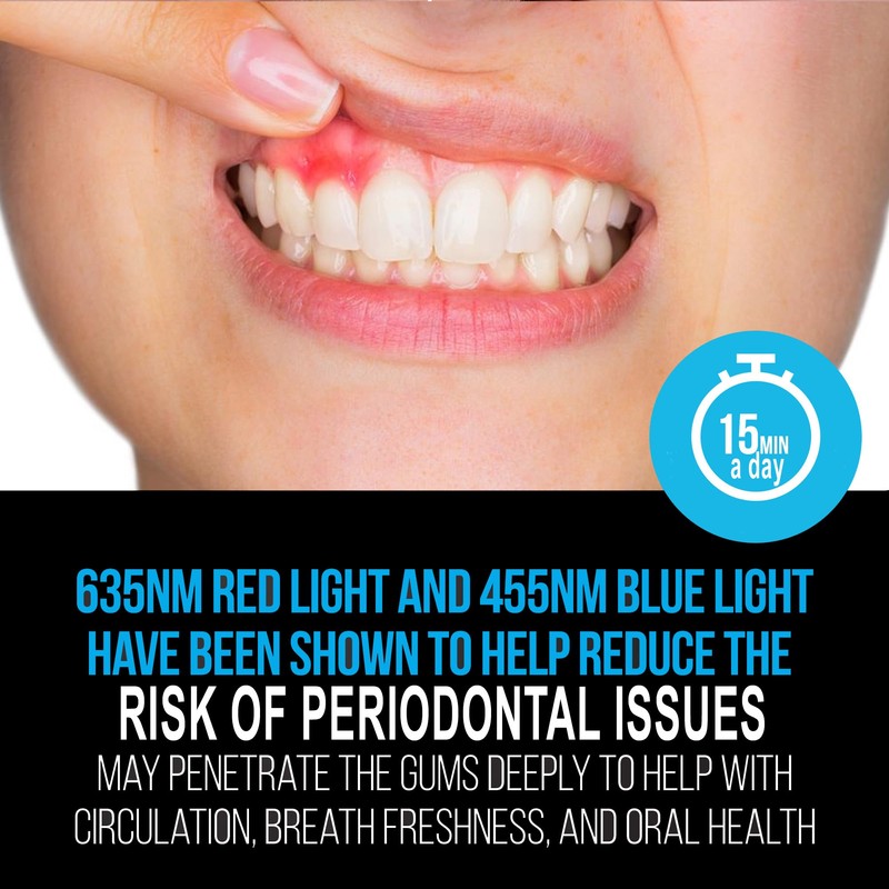 Starlite Smile Blue Light Red Light Gum Light, Periodontal Light,