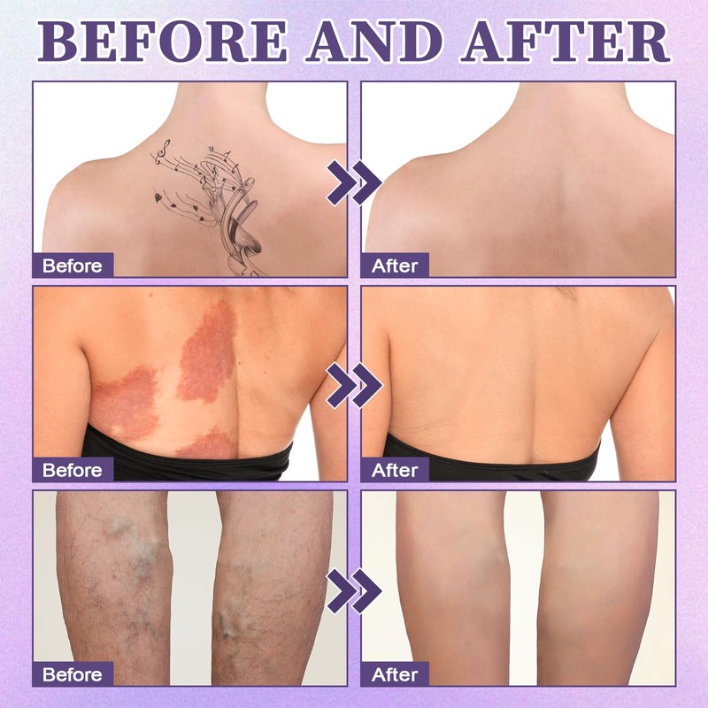 2Pcs Body Coverage Perfector, All Over Complexion Perfector, Natürliche Tattoo